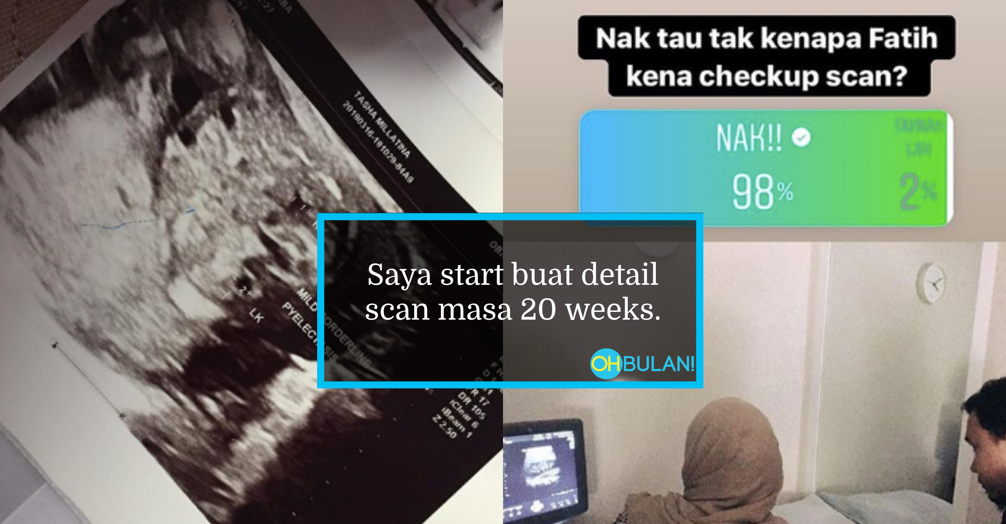 ‘Buah Pinggang Fatih Sedikit Membengkak’ – Wanita Kongsi Pentingnya Detail Scan Bayi Dalam Kandungan