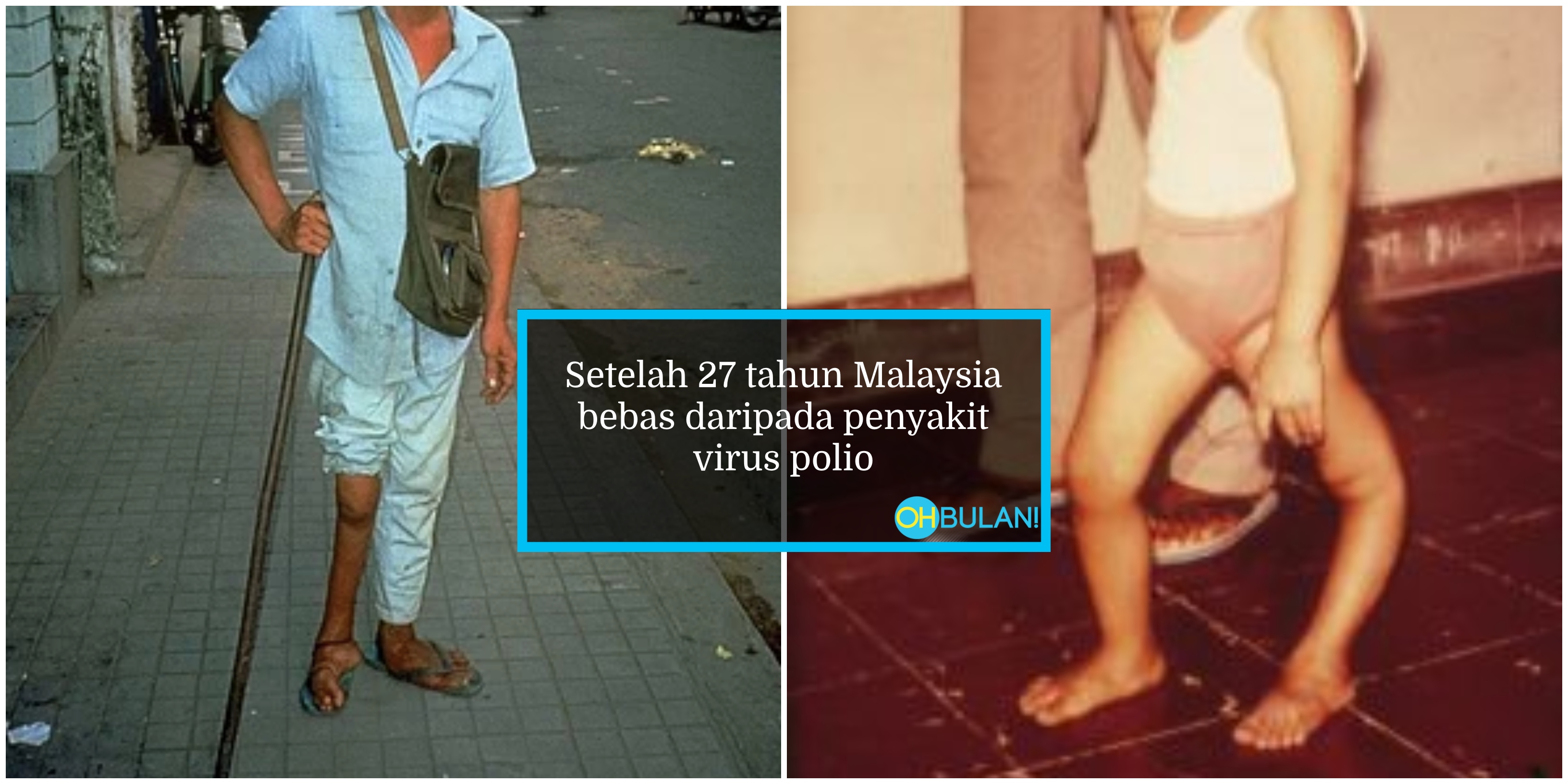Kes Pertama Di Malaysia Selepas 27 Tahun Malaysia Bebas Polio