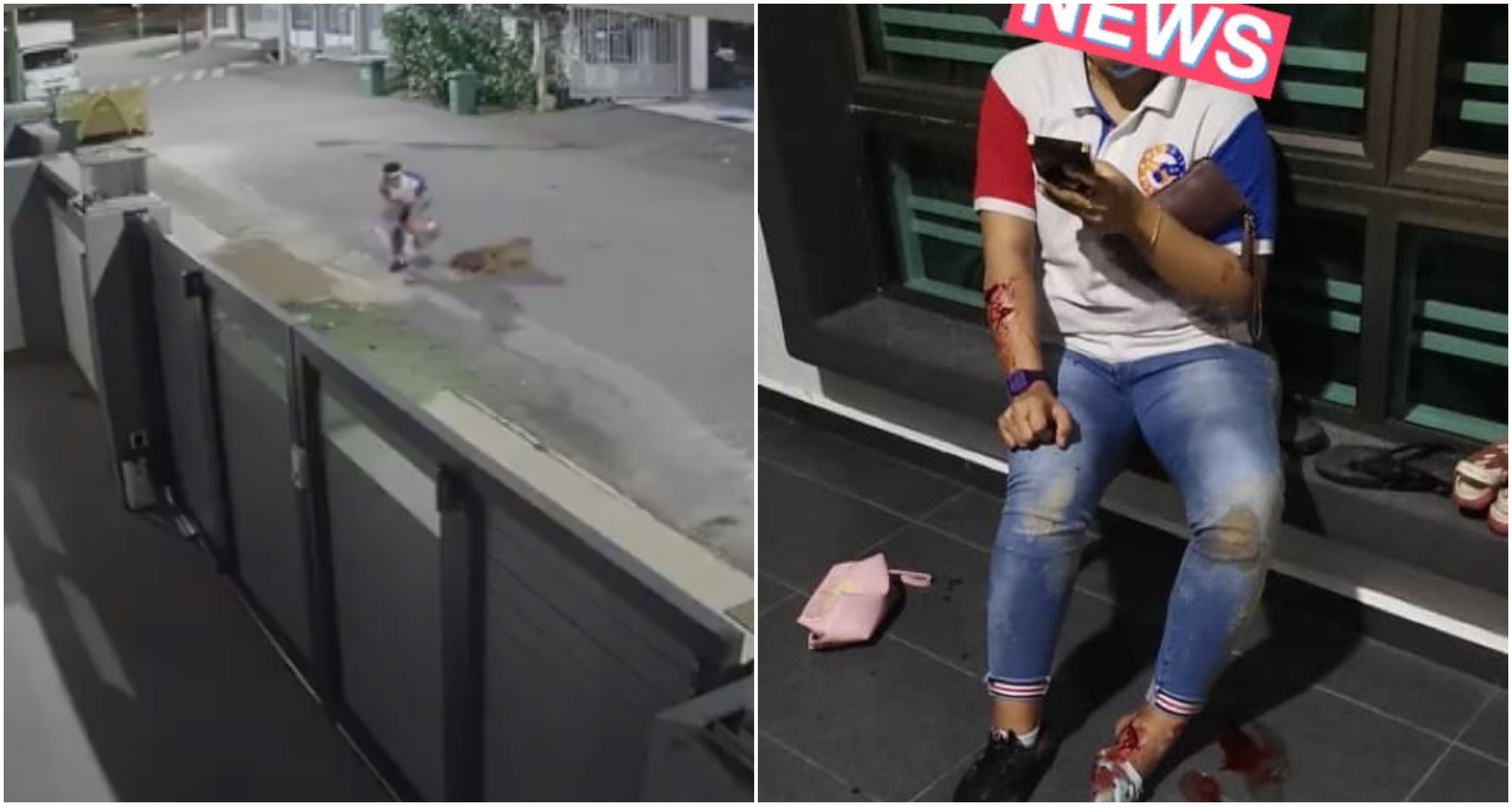[VIDEO] Padah Lupa Tutup Pagar, Wanita Cedera Parah Digigit Anjing!