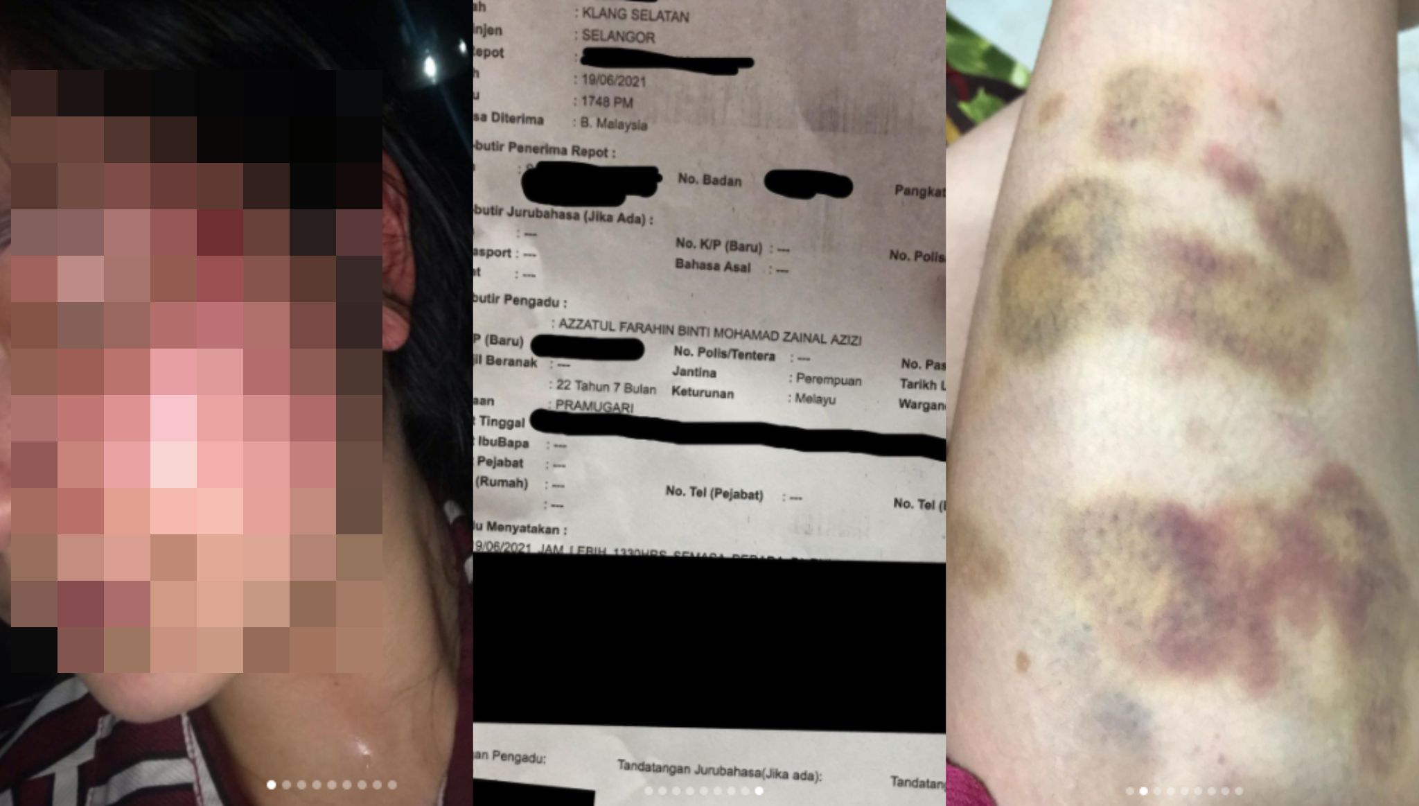 2 Tahun Bagi Peluang BF ‘Berubah’, Instafamous Akhirnya Lapor Polis Sering Dipukul