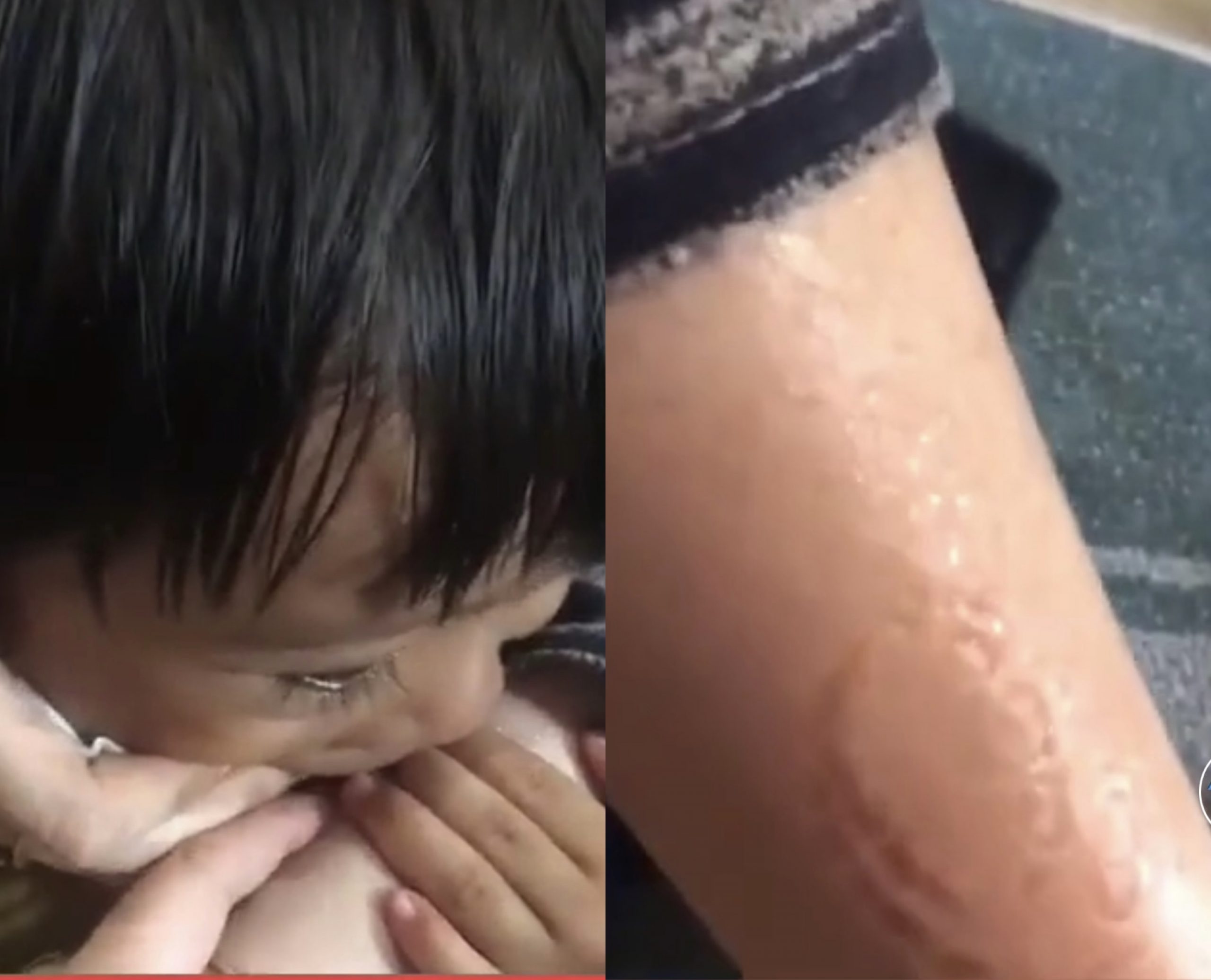 Kongsi Video Anak Gigit Tangan Sampai Lebam, Netizen Tegur Jangan Terlampau Manjakan Anak