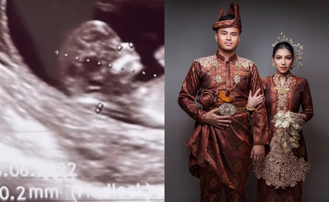 Selit Gambar Imbasan Ultrabunyi Dalam Video, Elisya Sandha Hamil Anak Pertama?